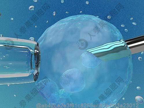 宿迁哪家肾损伤干细胞医院好