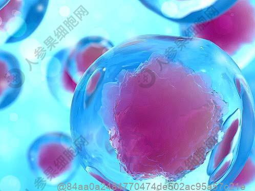 甲状腺彩超结论4a是什么意思