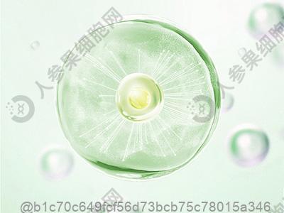 脑梗死患者有脑萎缩吗