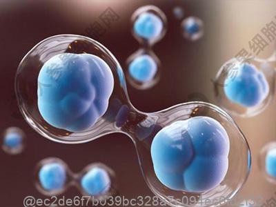 30岁患者CT提示轻度脑萎缩怎么回事