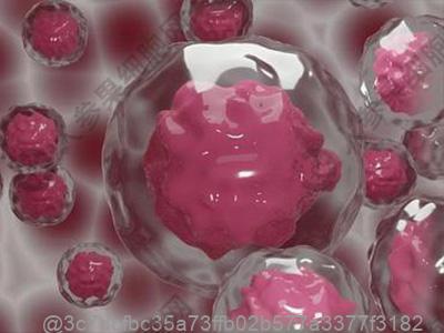 怎么治疗腔梗脑萎缩