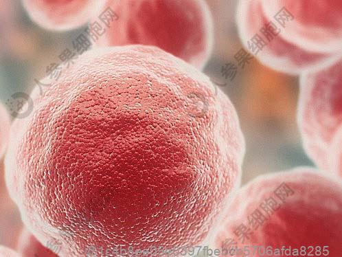 痛风早期10个征兆