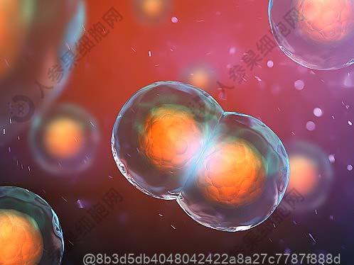 胰腺癌是怎么个症状