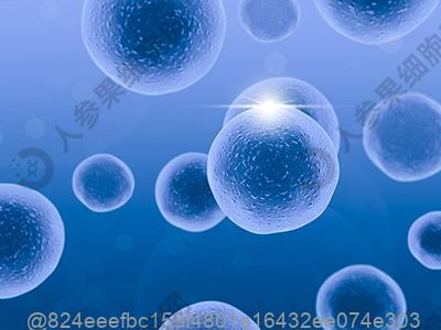 血流变看哪一项检查的是血脂